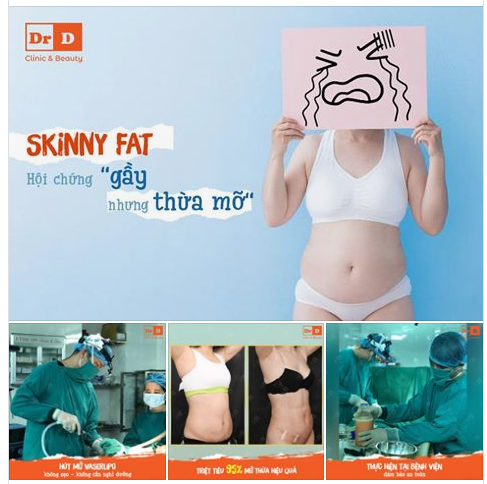 Bạn có thuộc "Hội skinny fat": Người gầy nhưng vẫn thừa mỡ bụng?