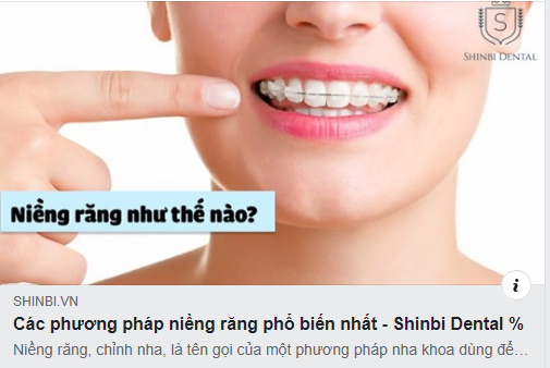 Bạn đang quan tâm đến các phương pháp niềng răng đang phổ biến nhất hiện nay?