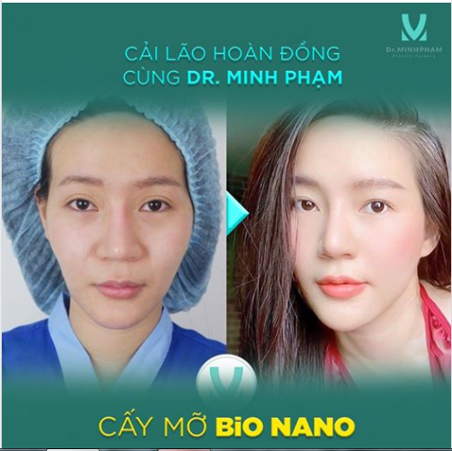 CẢI LÃO HOÀN ĐỒNG cùng Dr Minh Phạm108 CÁC TRƯỜNG HỢP CẦN CẤY M Ỡ TỰ THÂN