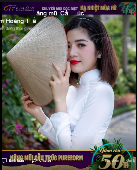 Cô nàng Kim Thi - nhân viên lễ tân tại Dr Hoàng Tuấn - ngày càng trở nên xinh đẹp hơn sau combo nâng mũi cấu trúc Pureform + nhấn mí