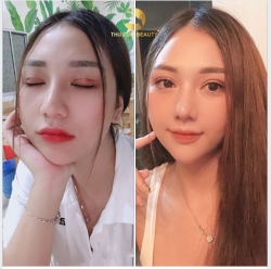 ĐỪNG ĐỂ MẮT 1 MÍ LÀM BẠN MẤT ĐIỂM