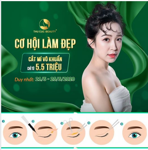 MẮT NAI CUỐN HÚT CHỈ TỪ 5,5 TR