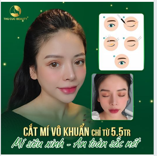 MÍ SIÊU XINH – AN TOÀN SẮC NÉT  ƯU ĐÃI CHỈ TỪ 5,5 TR