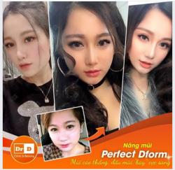 Nâng mũi Perfect Dform - Mũi cao thẳng, đầu mũi "bay" cực sang.