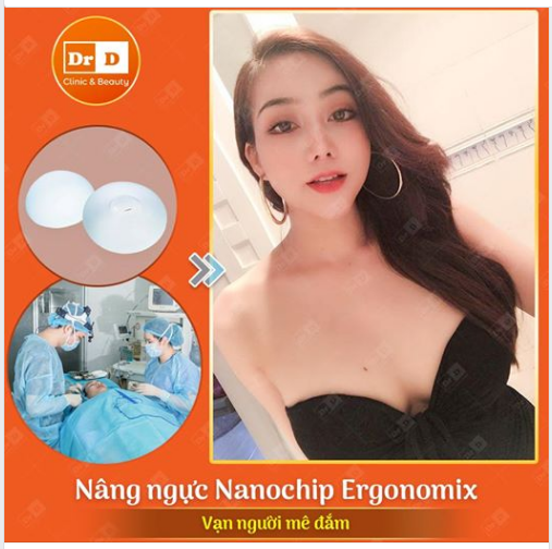 Nâng ngực Nanochip Ergonomix - Vạn người mê đắm