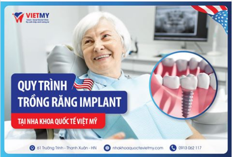 QUY TRÌNH TRỒNG RĂNG IMPLANT AN TOÀN TẠI NHA KHOA QUỐC TẾ VIỆT MỸ.