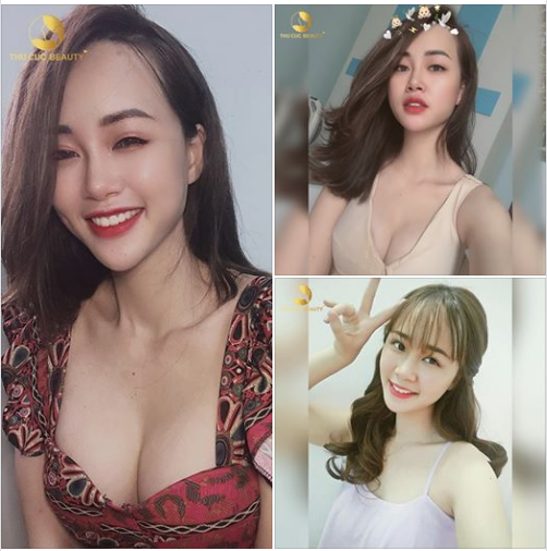 TẠM BIỆT “KIẾP 2 LƯNG” TỰ TIN KHOE V1 QUYẾN RŨ