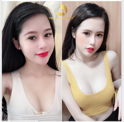 V1 "KHỦNG" CHỈ CẦN 5 NGÀY MẶC ÁO ĐỊNH HÌNH - 7 NGÀY ĐẸP "NẢY LỬA"