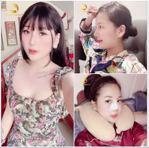 VÌ SAO NÂNG MŨI HIGH - LINE VÔ KHUẨN TẠI THU CÚC ĐƯỢC NHIỀU KH TIN TƯỞNG?