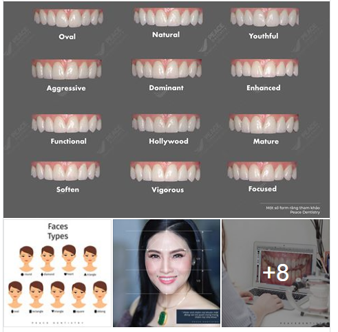 Chọn form răng sứ trong sự tương quan với các kiểu khuôn mặt và tính cách