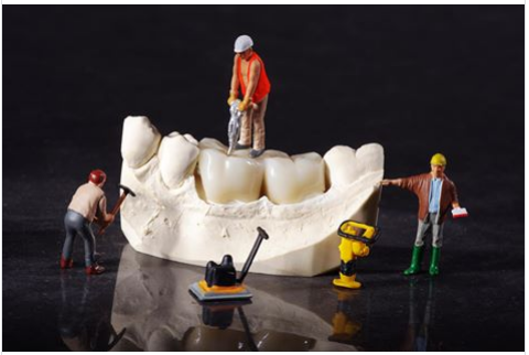 Có phải răng sứ càng bền chắc là răng sứ càng tốt