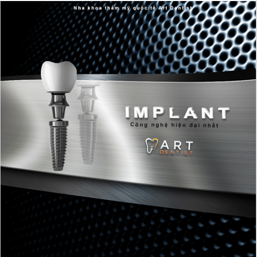 Implant và những lợi ích