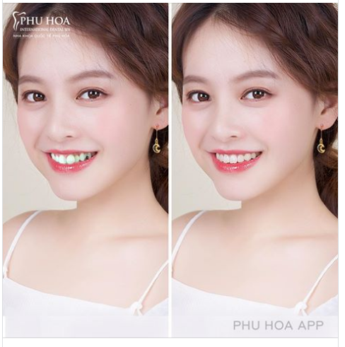 Mấy ngày này Faceapp nổi lên biến đổi giới tính. Nhưng ít ai biết ...