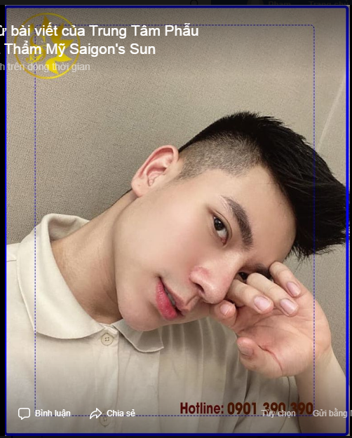 NAM NHÂN XUẤT THẦN QUA CHIẾC MŨI