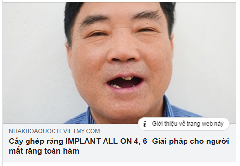 GIẢI PHÁP NÀO CHO NGƯỜI MẤT RĂNG TOÀN HÀM