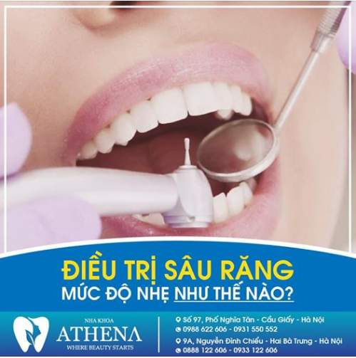 RĂNG SÂU Ở MỨC ĐỘ NHẸ là giai đoạn đầu tiên của bệnh sâu răng, biểu hiện không được rõ ràng và chưa gây ảnh hưởng cụ thể.