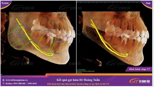 Trước mỗi ca phẫu thuật xương hàm mặt, khách hàng được chụp phim với công nghệ CT Conbeam.
