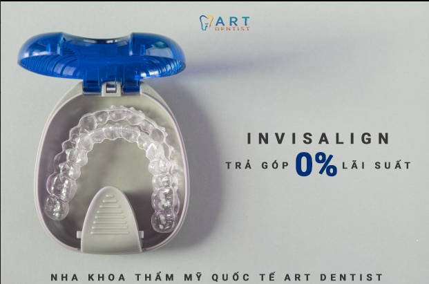 Art Dentist sẽ khuyến khích bạn nên sử dụng Invisalign