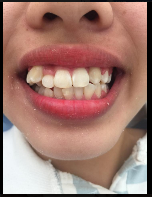 GÓC CẢNH BÁO Đây là hình ảnh răng một bạn nữ đến từ Thái Bình.