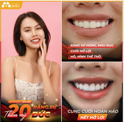 Người mẫu Tâm Như chia sẻ khi nhìn kết quả Thẩm mỹ 20 răng sứ