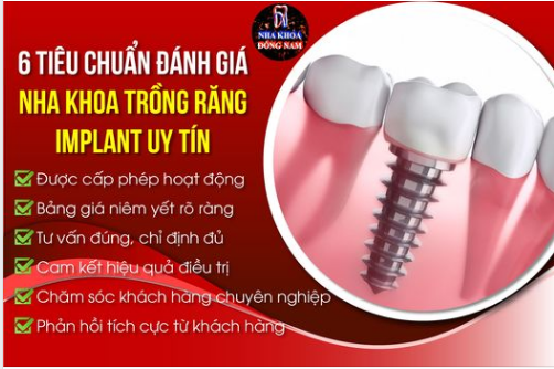 6 TIÊU CHUẨN đánh giá Nha khoa trồng răng Implant UY TÍN