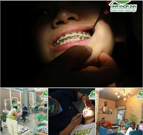Chủ nhật thường là ngày mà quý phụ huynh và các em nhỏ thường ghé nha khoa để tái khám và kiểm tra sức khỏe răng miệng nhiều nhất