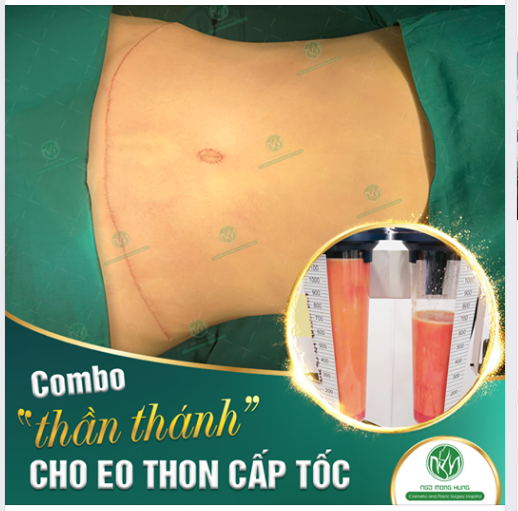  Combo “Thần Thánh” - Cho Eo Thon "Cấp Tốc"