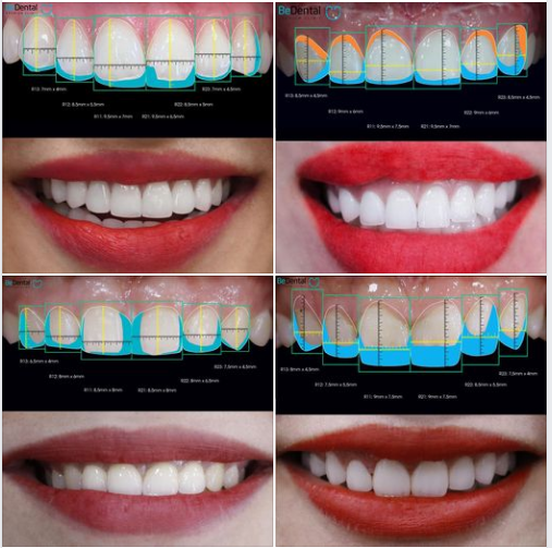 Khảo sát Cung răng đẹp Làm sao để đạt được?