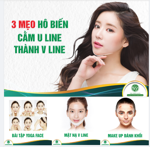 3 Mẹo “ Hô Biến” Cằm U-Line Thành V-Line