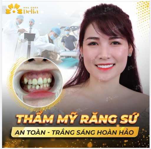 AN TÂM LÀM RĂNG SỨ "3 TỐT" TẠI NHA KHOA DELIA