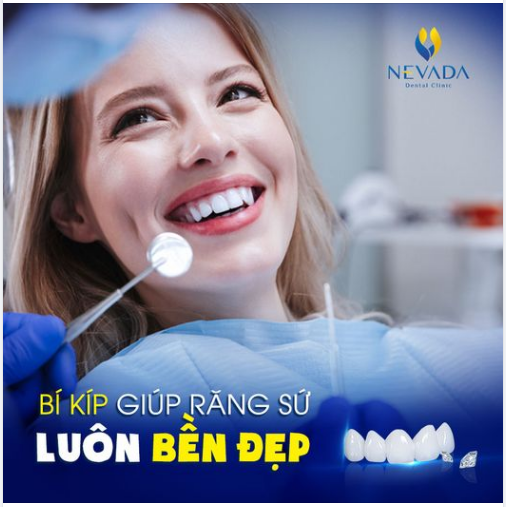 BÍ KÍP GIÚP RĂNG SỨ LUÔN BỀN ĐẸP