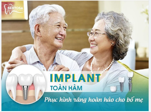 BỐ MẸ MẤT RĂNG, ĂN NHAI KÉM ĐỪNG THỜ Ơ GIẢI PHÁP: CẤY IMPLANT TOÀN HÀM