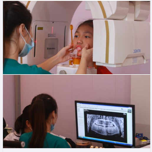 Chụp phim X- quang là 1 khâu rất quan trọng để bác sĩ xác định được vấn đề răng miệng, hay khi khách hàng muốn làm dịch vụ chỉnh nha, nhổ răng khôn đều rất cần thiết.