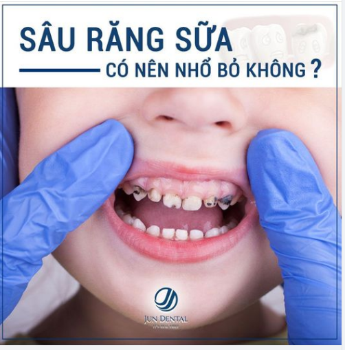 Co Phải Khi Răng Sữa Của Con Bị Sau Hay Lung Lay Bố Mẹ Thường Chủ