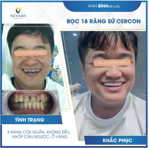 “Đổi nụ cười – Thay tướng số”