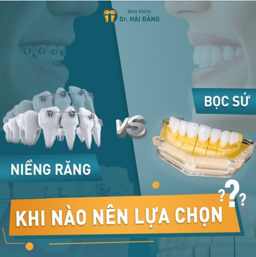 Nếu bạn đang quan tâm đến một trong hai phương pháp niềng răng hoặc bọc răng sứ để cải thiện hàm răng xấu, khiếm khuyết