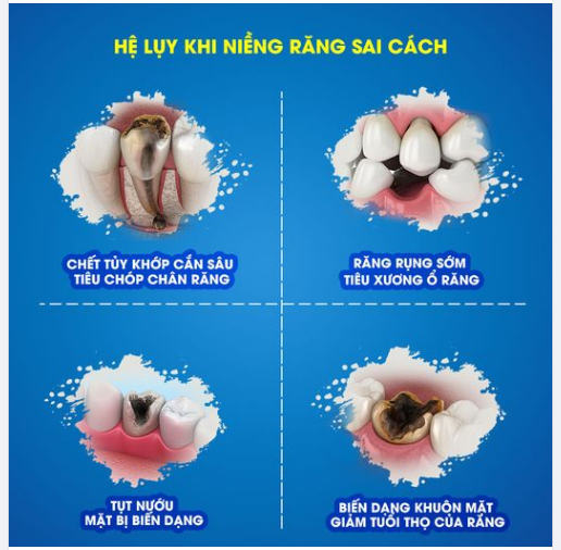 NIỀNG RĂNG SAI CÁCH - SAI MỘT LY ĐI MỘT DẶM