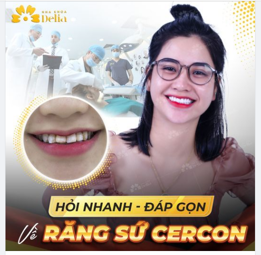 Răng sứ Cercon là gì? Đây là dòng răng toàn sứ được sản xuất từ Đức, được đánh giá là một trong những dòng răng sứ không kim loại tốt nhất hiện nay.