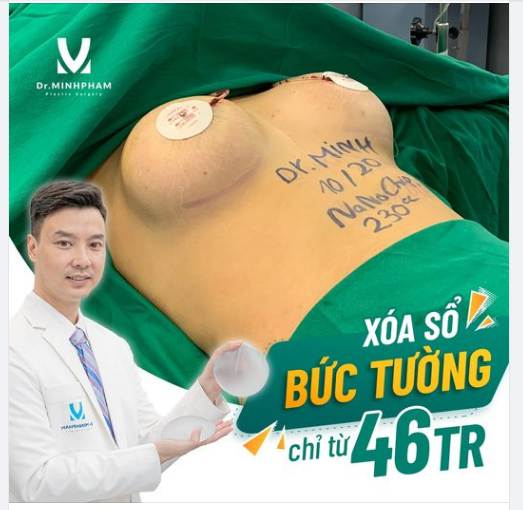Tại Dr Minh Phạm 108, kĩ thuật nâng cấp V1 nội soi tạo khe Y Line - Bí quyết xoá bỏ “ bức tường” , ng ực “chảy xệ , teo lép” sau sinh: