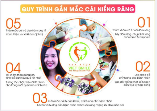 Tại Việt Smile, Chúng tôi luôn áp dụng quy trình chuẩn 5 bước từ khám tư vấn – chụp xquang – lấy dữ liệu – làm kế hoạch chi tiết – thực hiện gắn mắc cài niềng răng.