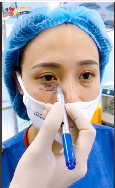 Các Combo SIÊU HOT dành cho đôi mắt tại Kangnam - Khuyến mãi CỰC HOT lên đến 35% trong tháng sinh nhật tròn 10 năm ​​​​​​​