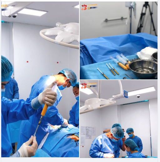 Cận cảnh các bác sĩ tại Kangnam thực hiện Cấy mỡ mặt tự thân Nanofat.