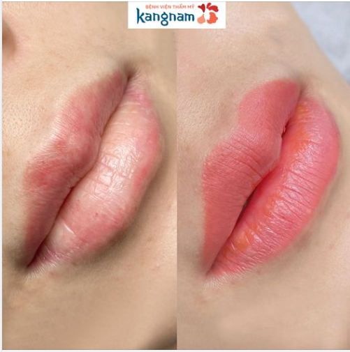 Chiếc môi xinh xinh thứ 5 trong buổi sáng cuối tuần tại Kangnam