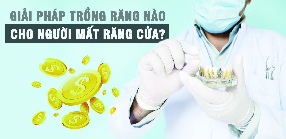 GIẢI PHÁP CHO NGƯỜI MẤT RĂNG CỬA