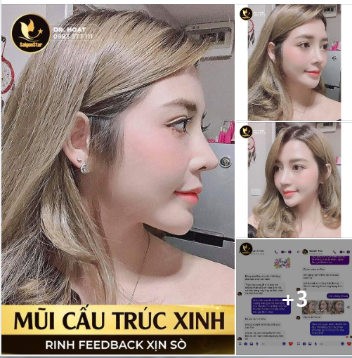 MŨI CẤU TRÚC XINH - RINH FEEDBACK XỊN SÒ ​​​​​​​