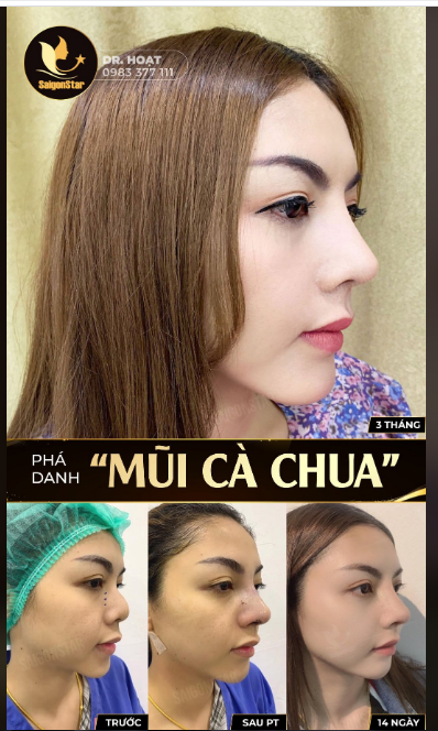 PHÁ DANH "MŨI CÀ CHUA" CÙNG QUỲNH TRÂN