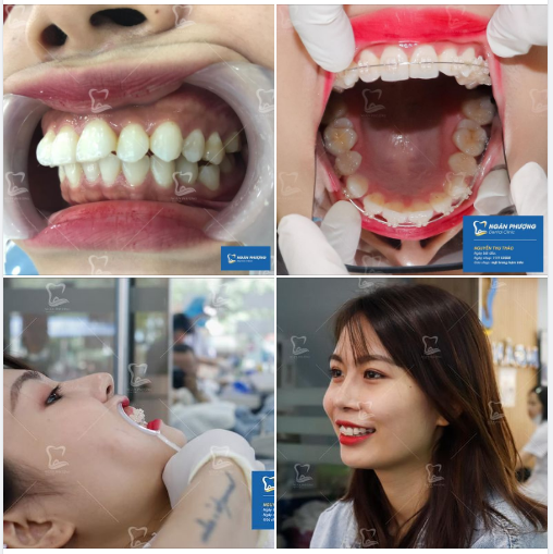 Răng xấu có thể không phải lỗi của bạn