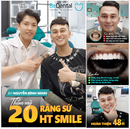 Sự thay đổi sau thẩm mỹ 20 răng sứ của khách hàng Binh Minh tại Be đã làm cho tổng thể diện mạo gương mặt của anh điển trai và cá tính hơn