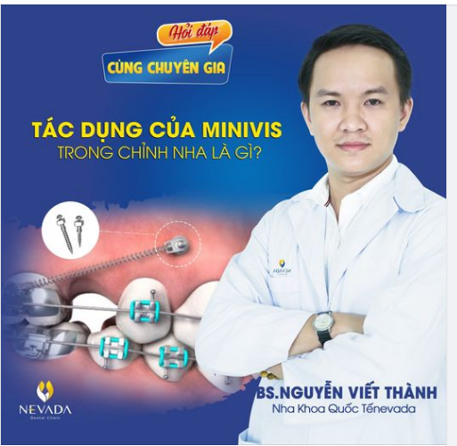 TÁC DỤNG CỦA MINIVIS TRONG CHỈNH NHA LÀ GÌ??