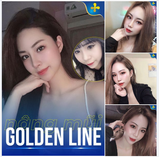 Tham khảo ngay dáng mũi Golden Line thương hiệu Dr. Tống Hải dáng mũi thần thánh được hàng chục ngàn chị em vô cùng ưa chuộng!